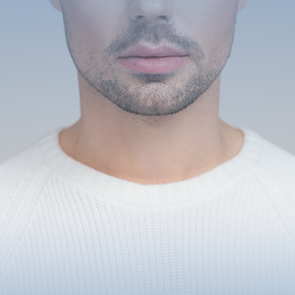 ليزر تحديد الشنب للرجال ( الرياض)