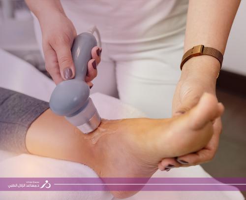 ( للنساء ) ليزر شعر اصابع الأرجل