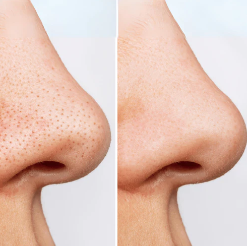 انوا غسول زيتي هارتليف للتحكم في المسام 200مل