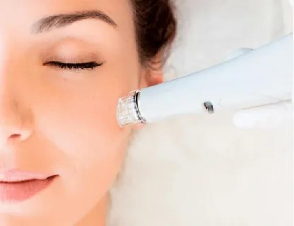 اكتشفي سر نضارة بشرتك مع الة تنظيف الوجه المتطورة