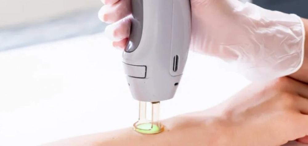 تعرفي على طرق اختيار افضل جهاز ليزر لازالة الشعر