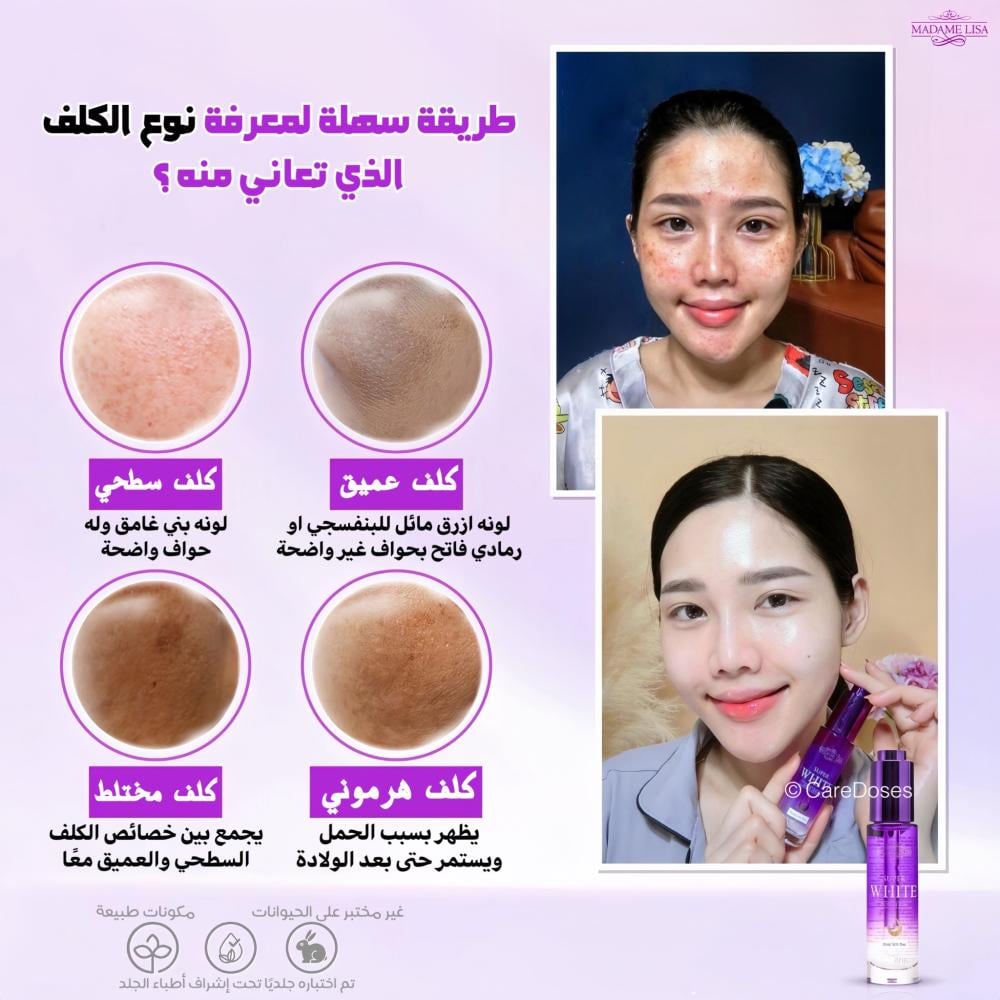 سيروم سوبر وايت الجرعة الفائقة للتبييض المكثف Madame Lisa Super White Dose Serum30ml
