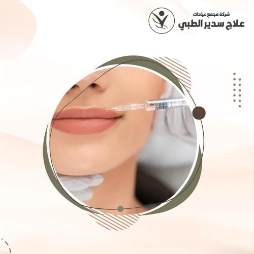 اذابة الفيلر