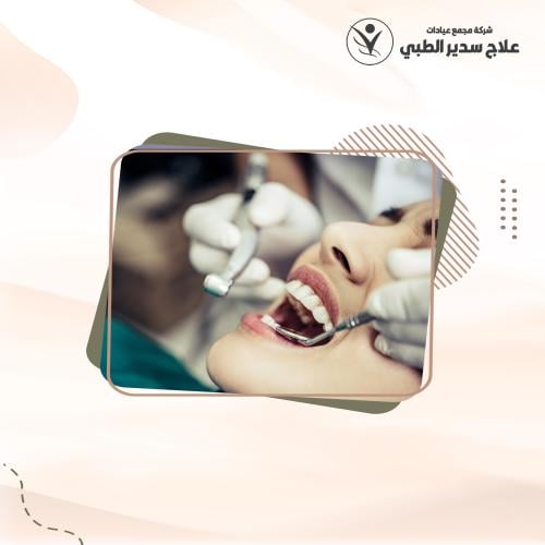 تنظيف وتلميع الأسنان
