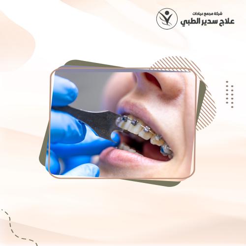 دفعة أولي التقويم العلاجي