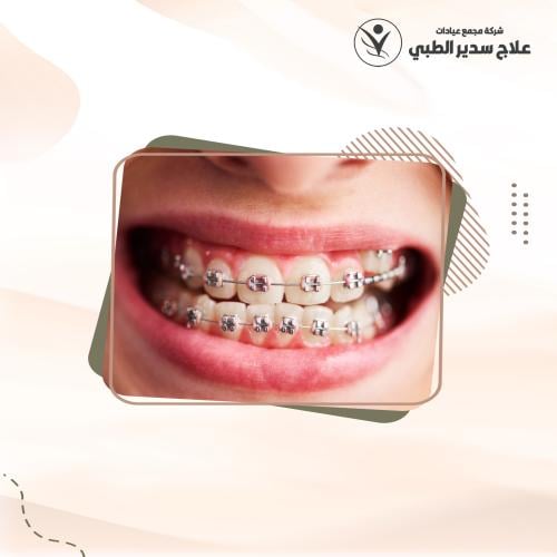 قسط شهري للتقويم العلاجي