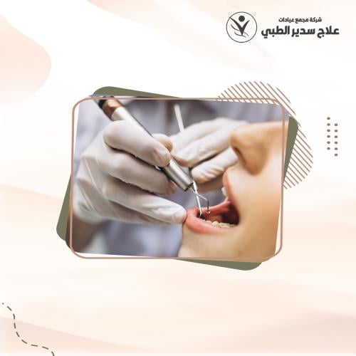 تنظيف الاسنان بجهاز AIR STREAM