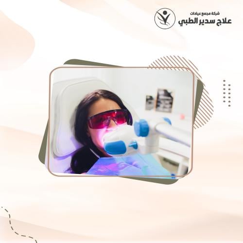 تبييض الاسنان ليزر ZOOM + تلميع الاسنان مجاناً
