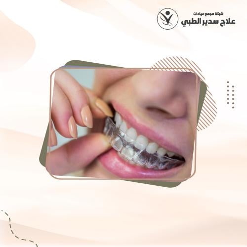 التقويم العلاجي الشفاف