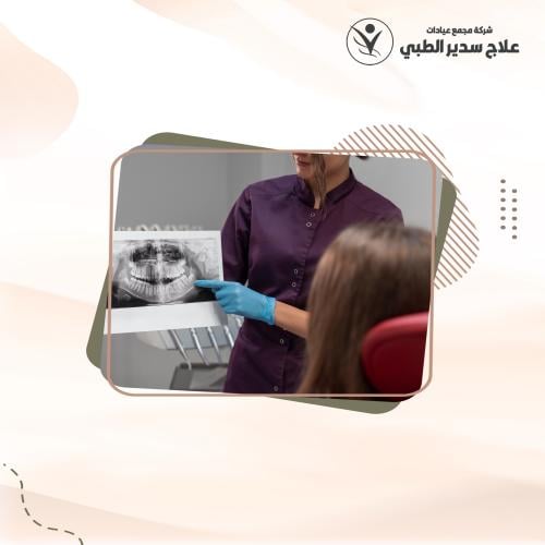 اشعة الأسنان المقطعية CBCT