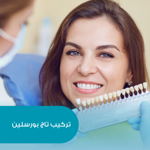 تركيب تاج بورسلين -للسن الواحد