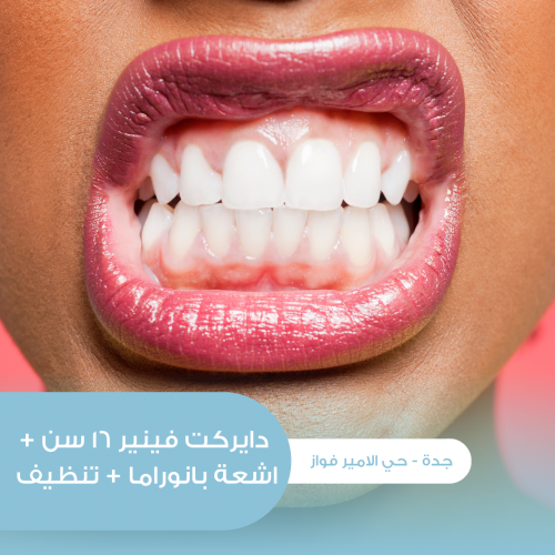 دايركت فينير 16 سن + أشعة بانوراما + تنظيف