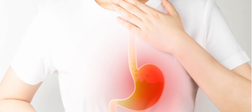 Esophageal reflux - causes and treatments for esophageal reflux
