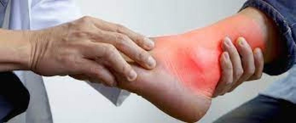 Gout symptoms and treatment with medications
