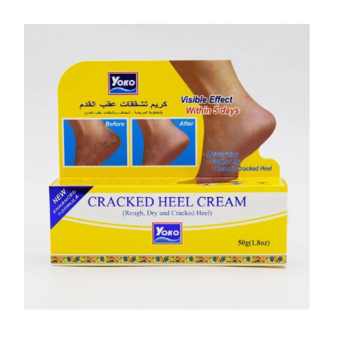 كريم تشققات عقب القدم من يوكو - 50 مل