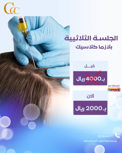 الجلسة الثلاثية-بلازما كلاسيك