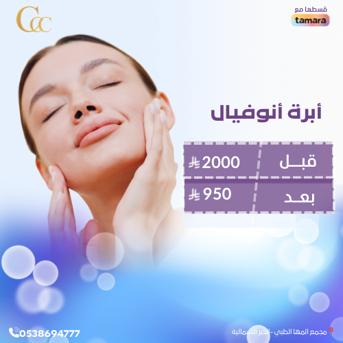 ابرة انوفيال