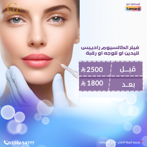 فيلر الكاليسوم رادييس لليدين او للوجه او رقبه