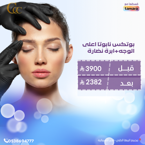 بوتكس نابوتا اعلى الوجه +ابرة نضارة