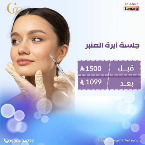 جلسة ابرة العنبر