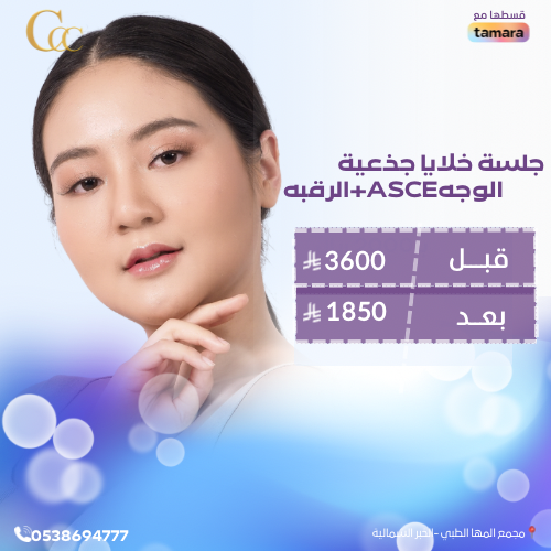 جلسة خلايا جذعية الوجة+ الرقبة ASCE