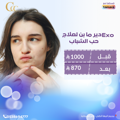 Exo ديرما بن لعلاج حب الشباب
