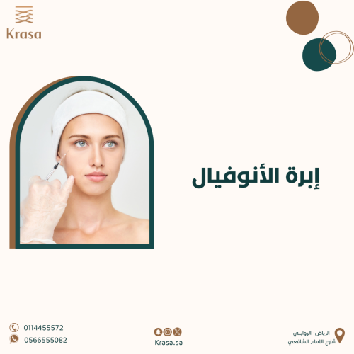 ابرة الانوفيال
