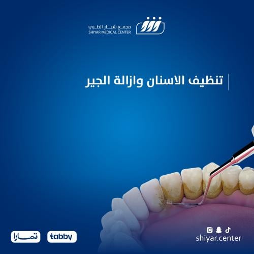 تنظيف الاسنان وازالة الجير