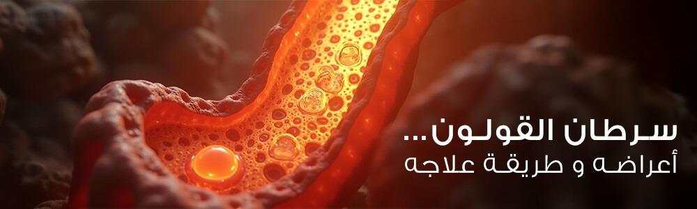 سرطان القولون.. أعراضه و طريقة علاجه