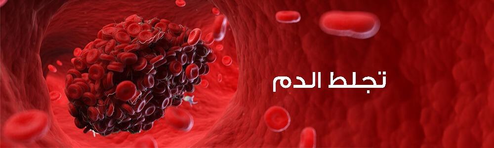 Causes of Blood clotting, Symptoms, and treatment