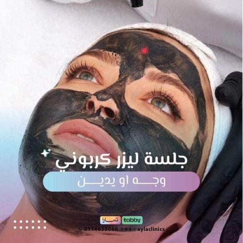 جلسة ليزر كربوني للوجه او اليدين