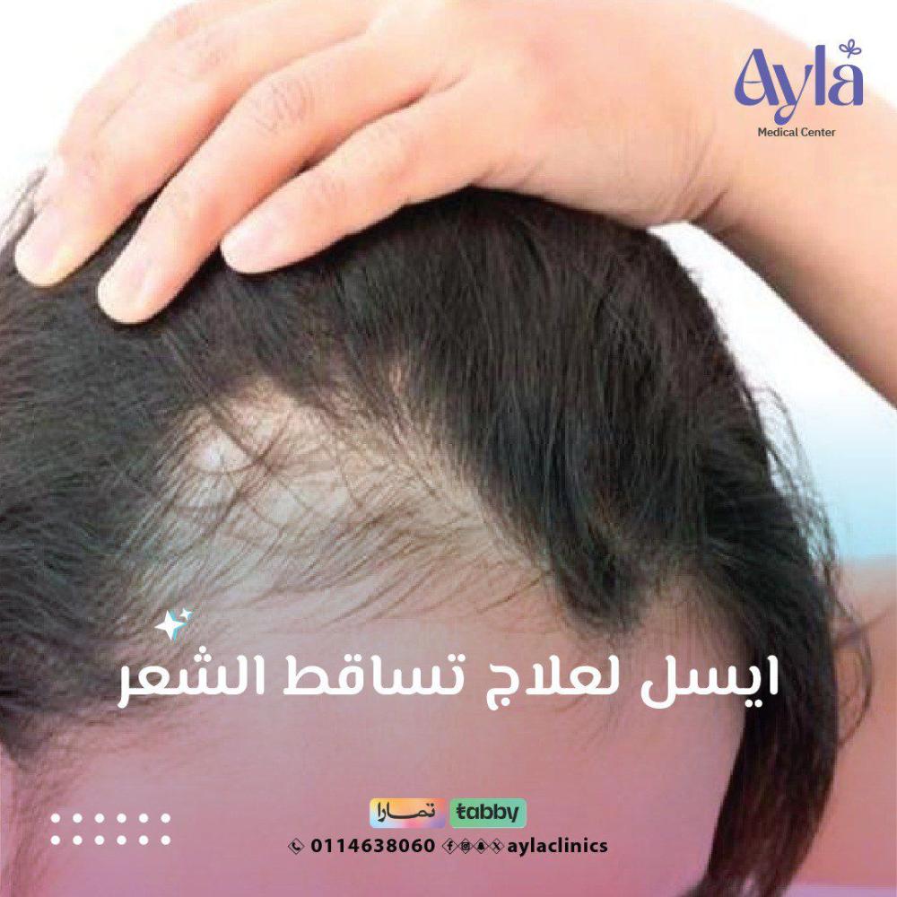 الايسل لتعزيز نمو الشعر وايقاف التساقط