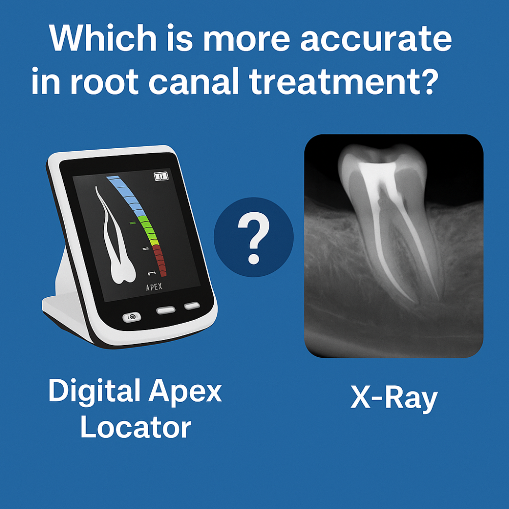 محدد الذروة الرقمي أم الأشعة السينية؟ أيهما أكثر دقة في علاج العصب؟
