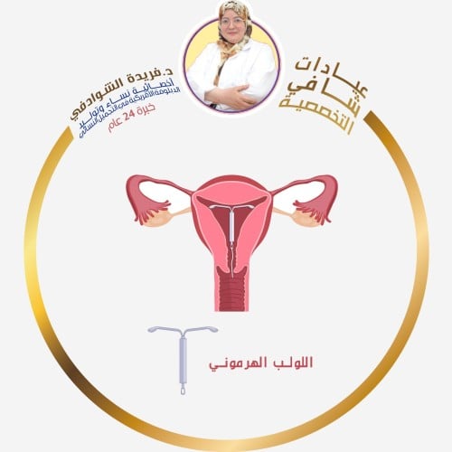 تركيب لولب هرموني شامل اللولب و التركيب و السونار