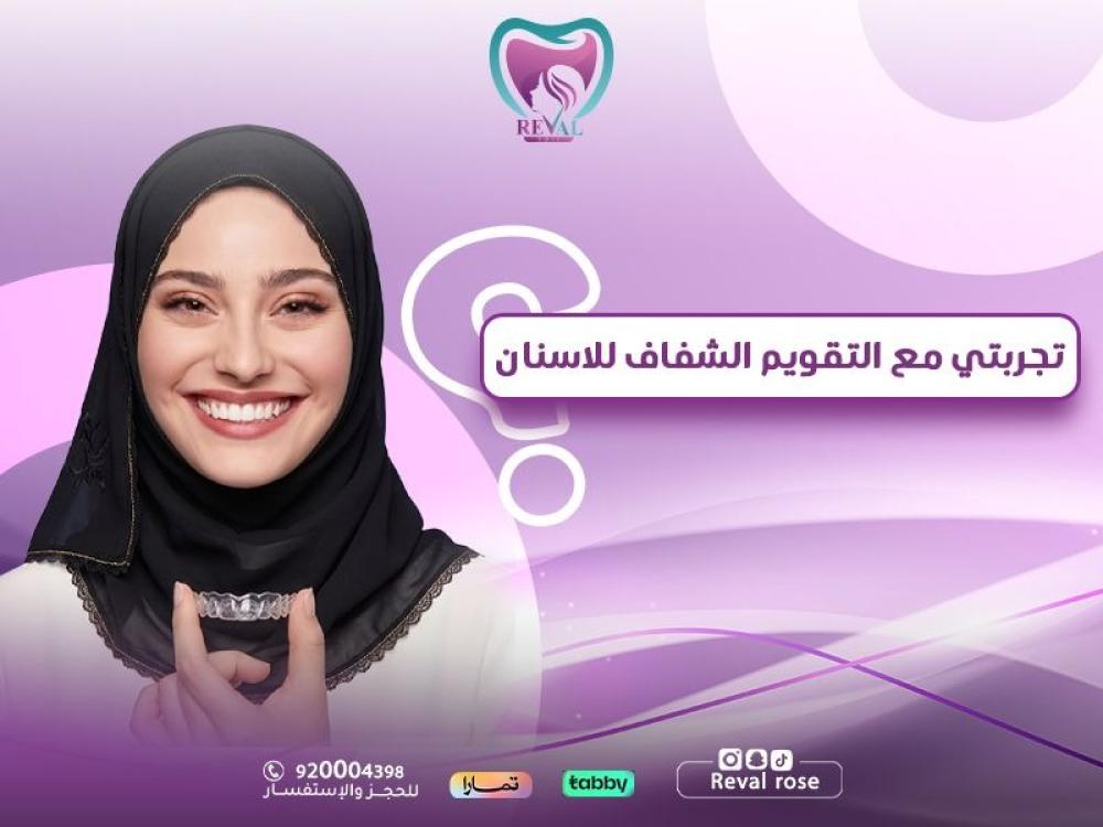 تجربتي مع التقويم الشفاف للاسنان: من اللحظة الأولى حتى أفضل النتائج