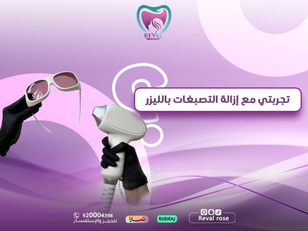 تجربتي مع إزالة التصبغات بالليزر: هل الليزر يزيل التصبغات نهائيا؟