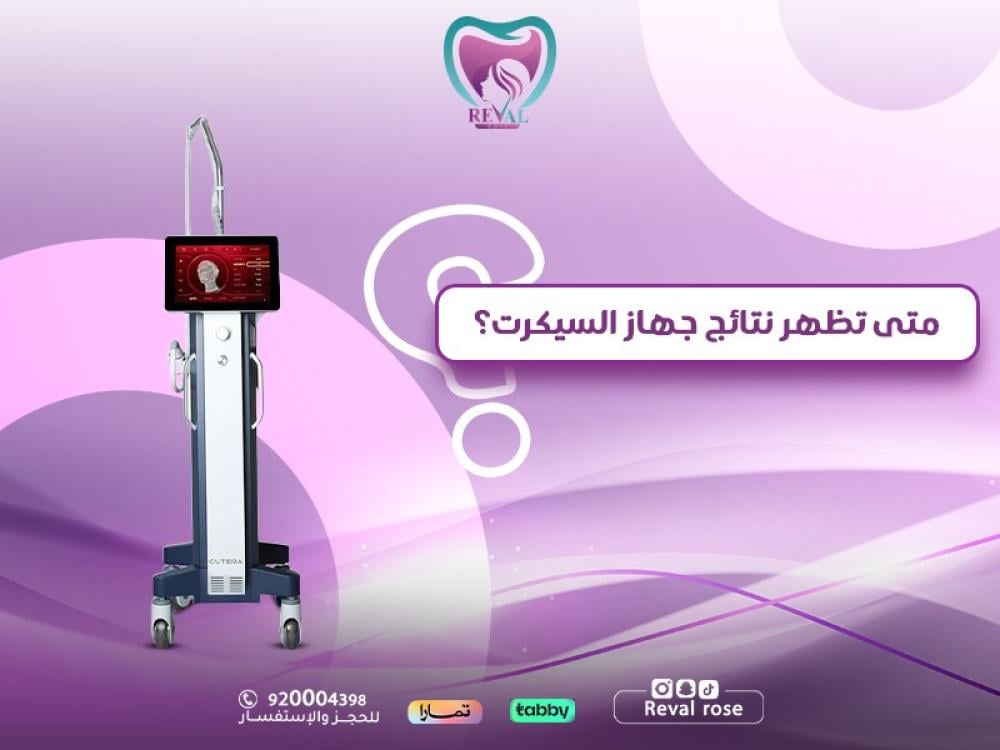 متى تظهر نتائج جهاز السيكرت — وكيف تحجزين جلسة (Secret RF)  اليوم؟