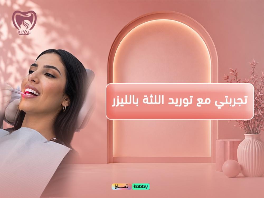 تجربتي مع توريد اللثة بالليزر: من ابتسامة داكنة إلى ابتسامة جذابة