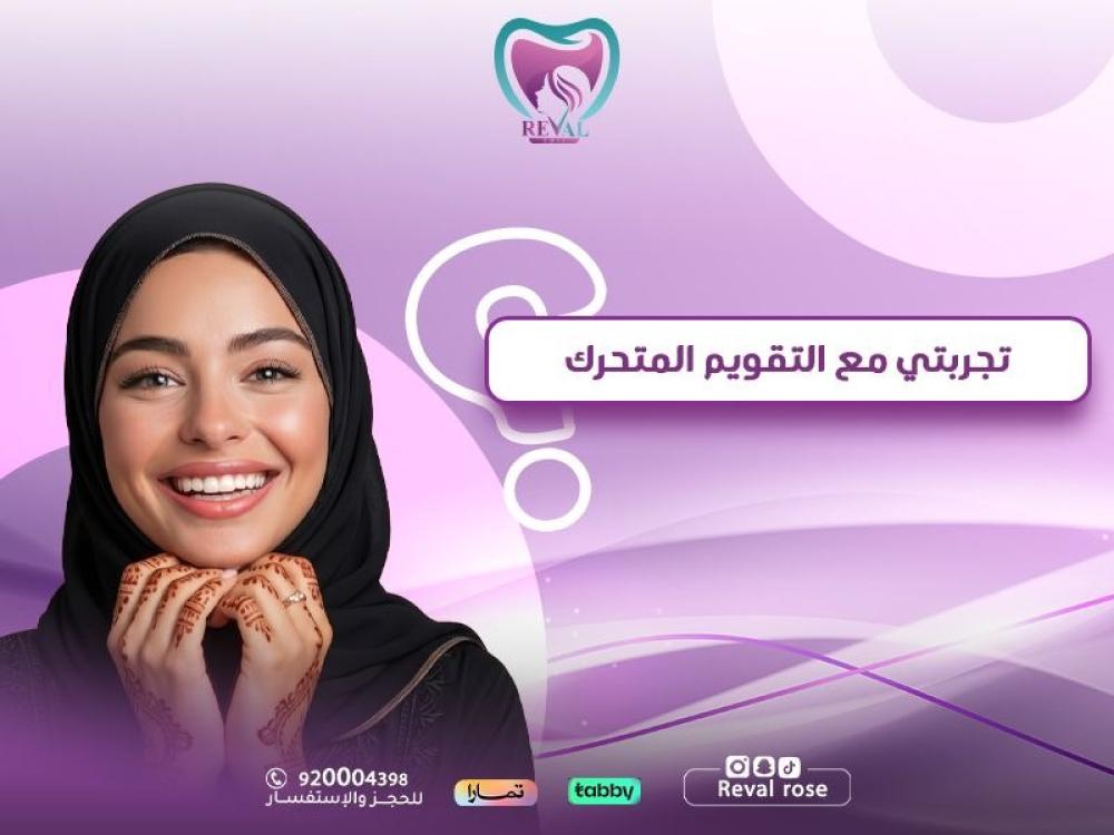 تجربتي مع التقويم المتحرك: كل ما تريد معرفته قبل البدء
