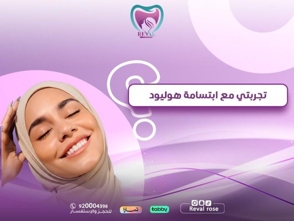 تجربتي مع ابتسامة هوليود