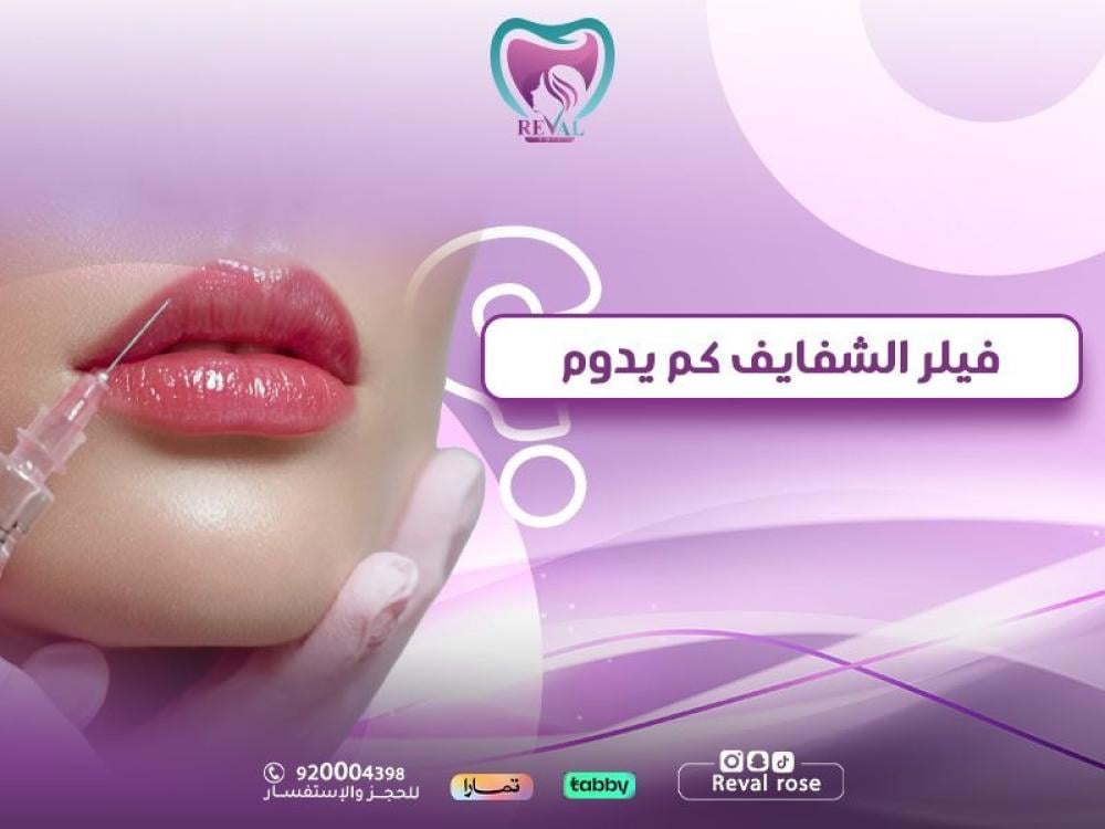 فيلر الشفايف كم يدوم — دليلك الشامل لنتائج مثالية تدوم