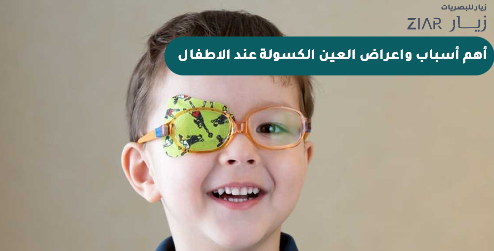 أهم أسباب واعراض العين الكسولة عند الاطفال