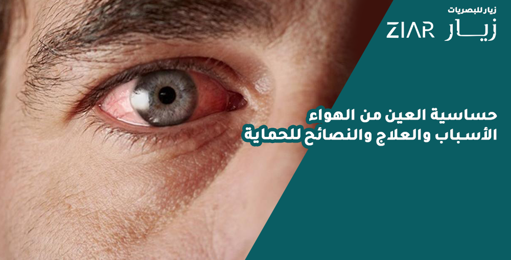 حساسية العين من الهواء: الأسباب والعلاج والنصائح للحماية