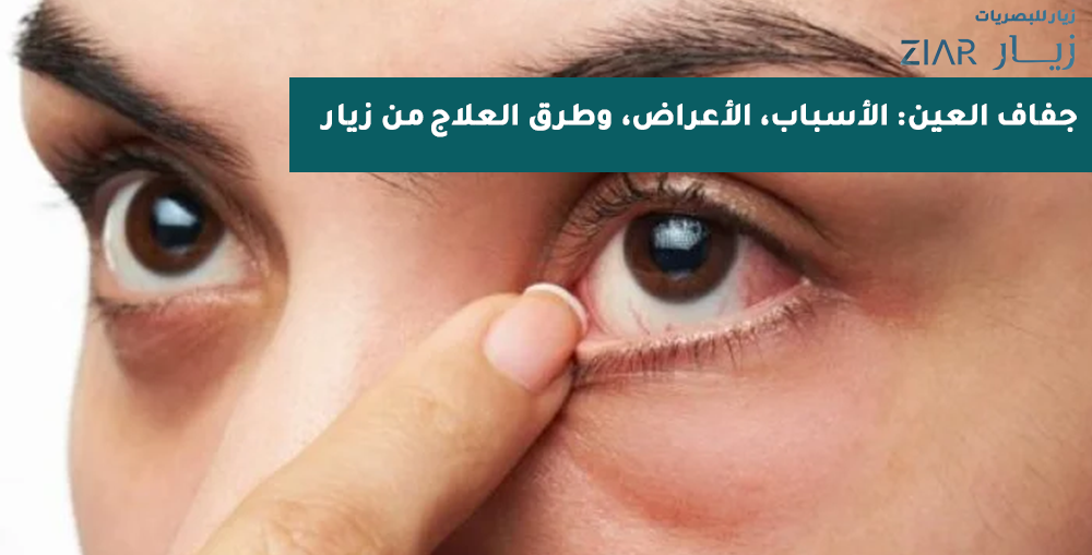 جفاف العين: الأسباب، الأعراض، وطرق العلاج من زيار