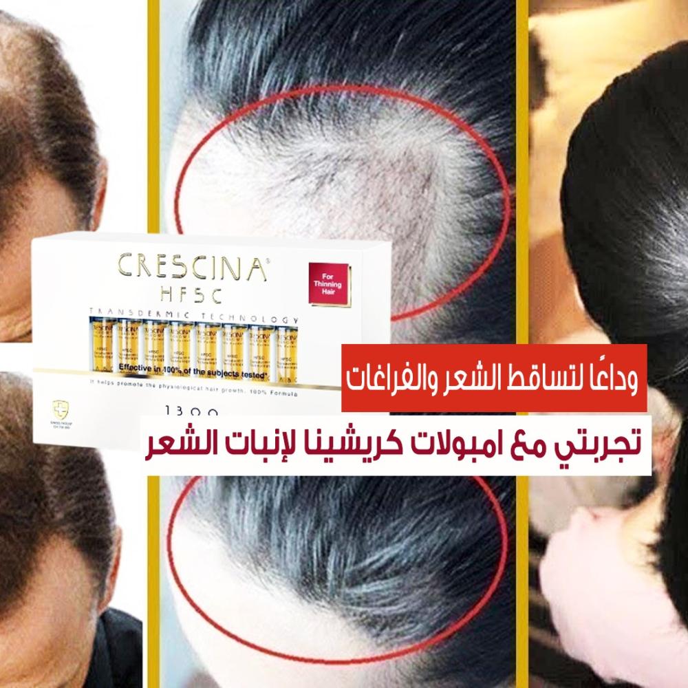 تجربتي مع امبولات كريشينا لإنبات الشعر