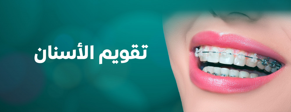 خيارات تقويم الأسنان السريعة