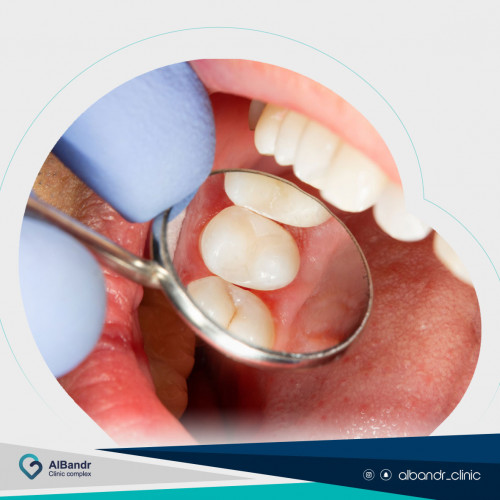 الحشوات التجميلية