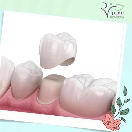 اشعة اسنان 3D