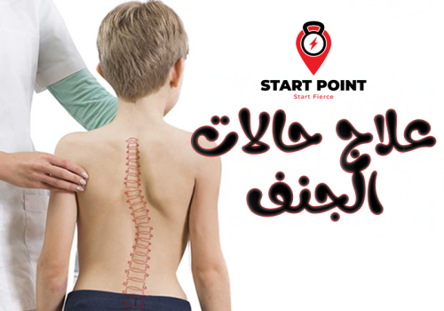 الجنف