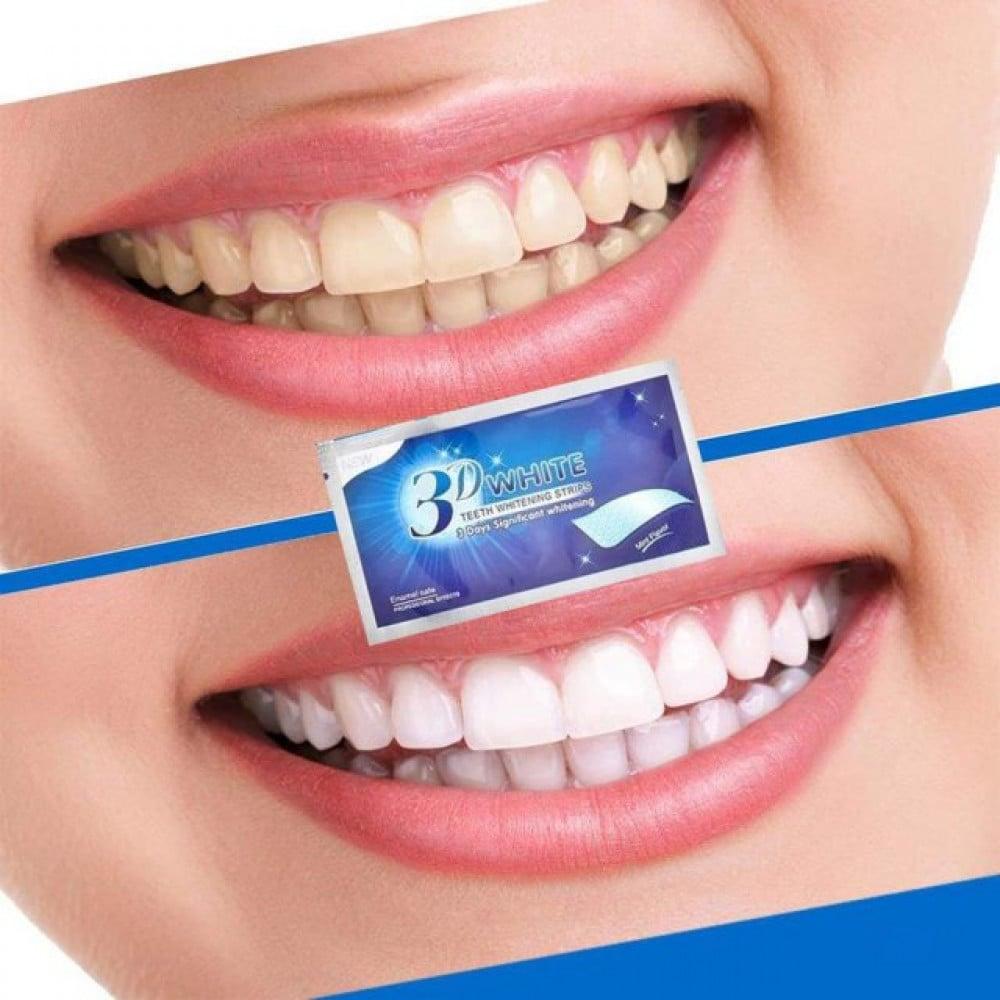 كريست لصقات تبييض الاسنان 6 مراحل - 20 لصقة